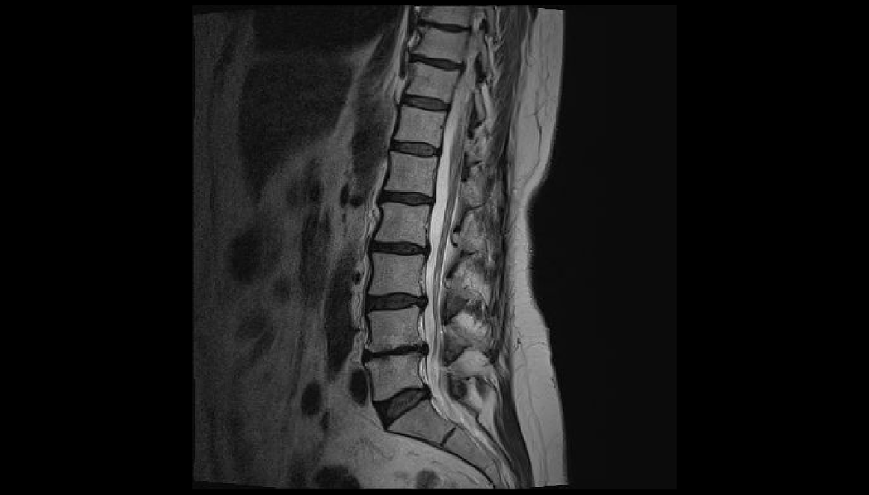 Diagnosis of low back pain