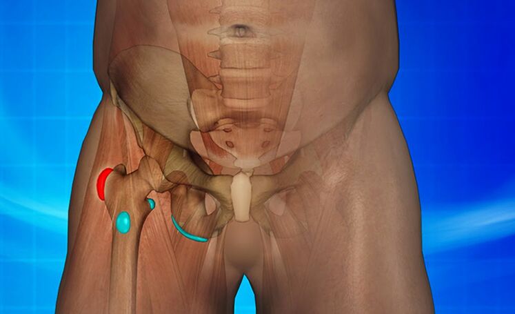 Hip Inflammation Causes Pain