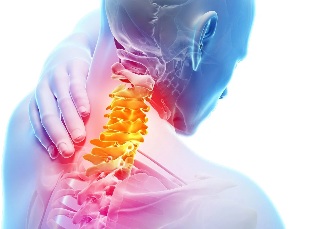 Cervical back pain