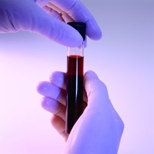 Blood in test tube